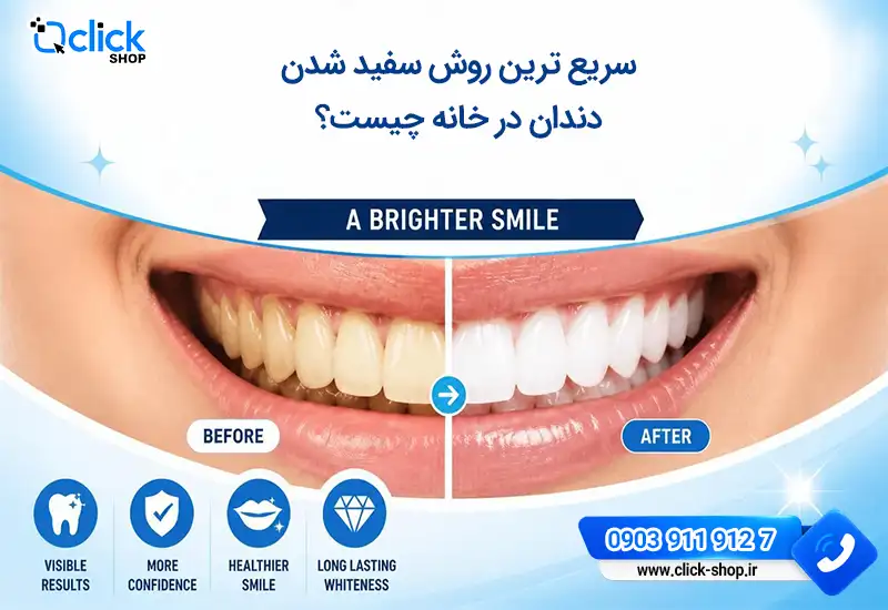 سریع ترین روش سفید کردن دندان