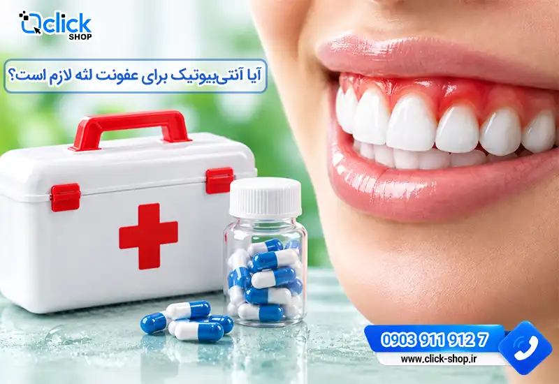 درمان عفونت لثه با آنتی بیوتیک